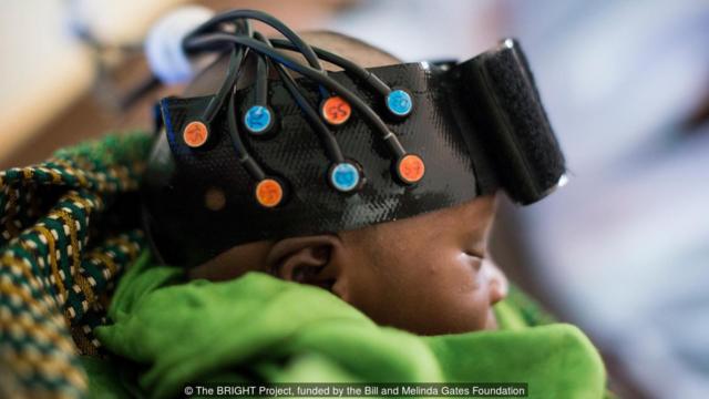 婴儿实验室用红外光谱法研究冈比亚婴儿营养不良的影响（Credit：光明的专案，由盖茨基金会资助）