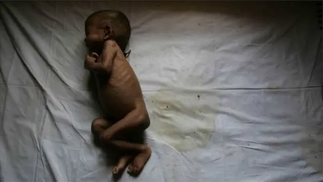 भारत में स्वास्थ्य व्यवस्था