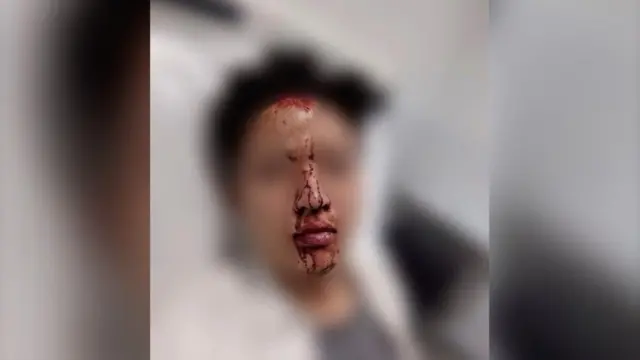 알란(가명)은 중국인 남성으로부터 집단 폭행을 당했다고 주장한다