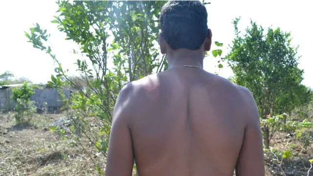 त्वचाविकारामुळे लुटे यांच्या शरीरावर पुरळ उठल्याचं दिसून येतं.