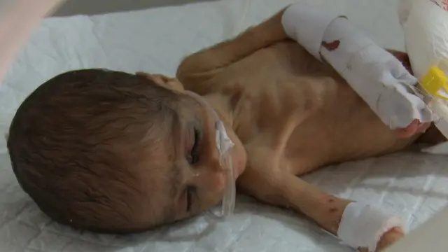 نومولود بچے