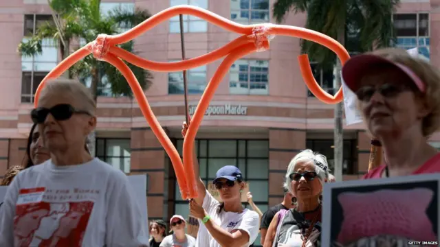 ਰੋਕੀਟੈਂਸਕੀ ਸਿੰਡਰੋਮ (ਸੰਕੇਤਕ ਤਸਵੀਰ)