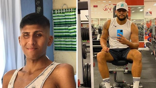 Vitor Ramos, 29, antes e depois do tratamento para Aids