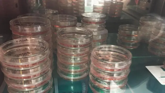 लैब में ब्रेन सेल