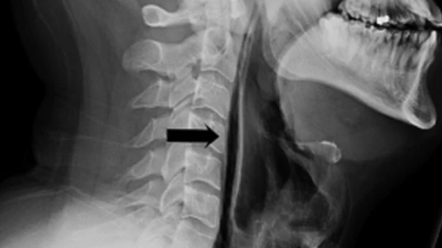 ব্রিটেন