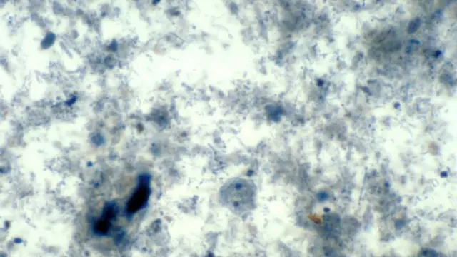โฉมหน้าเชื้อปรสิต Dientamoeba fragilis