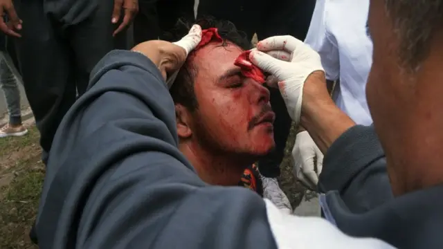 Un herido en protestas en Honduras.