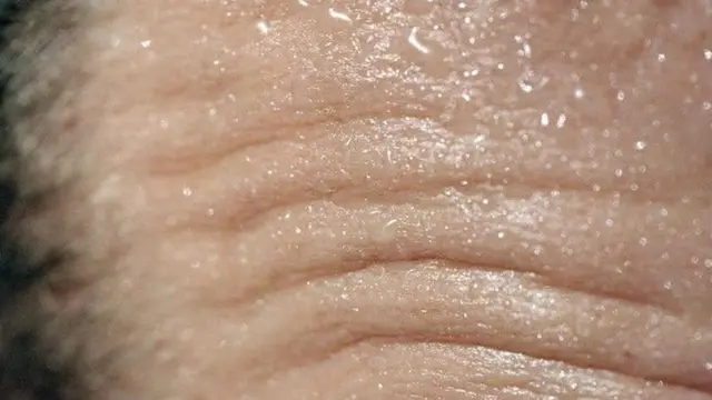 Піт на шкірі