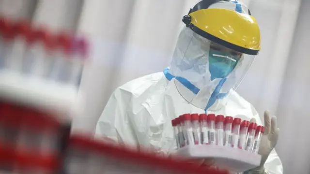 கொரோனா பரிசோதனை