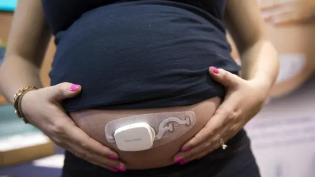 يمكن تتبع حال الجنين في رحم أمه ذاتيا من خلال منتجات تقنية حديثة