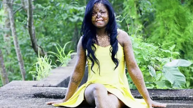 Juliana sentada em área esverdeada, posando para foto