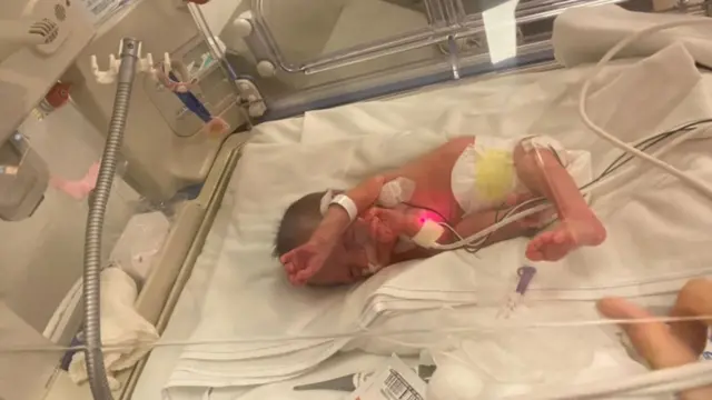 Jacinta en la incubadora