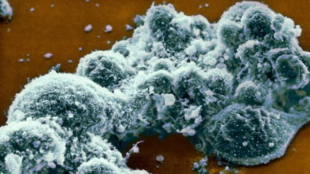 వైరస్లు