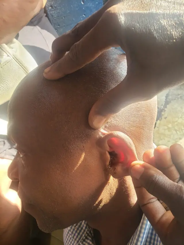 Ẹjẹ n da jade ni eti Onigbese ti wọn so mọlẹ