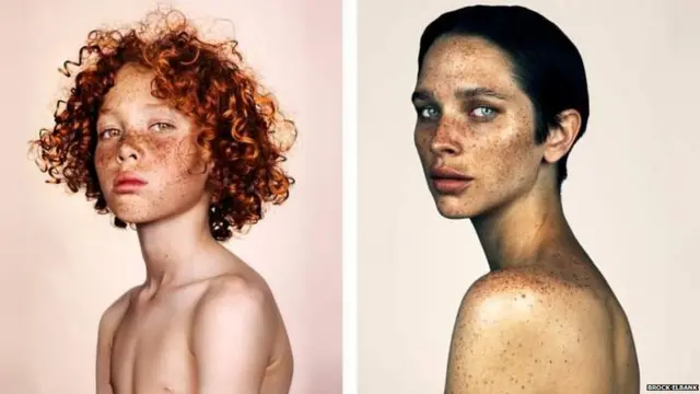 ફ્રેકલ્સ ધરાવતા લોકોની તસવીરો