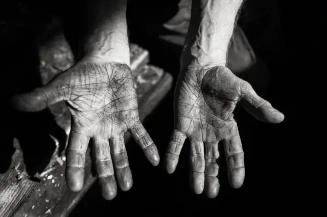 ایک آدمی کے ہاتھ کی ہتھیلیاں