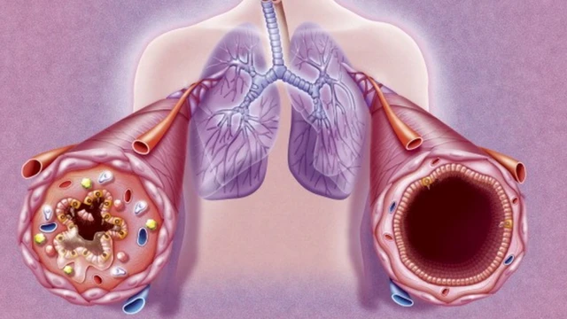 Ilustraçãocomo jogar roleta e ganhar dinheirobrônquios e do sistema respiratória