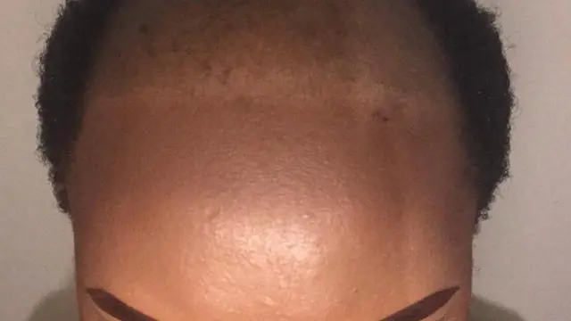 ప్రతీకాత్మక చిత్రం