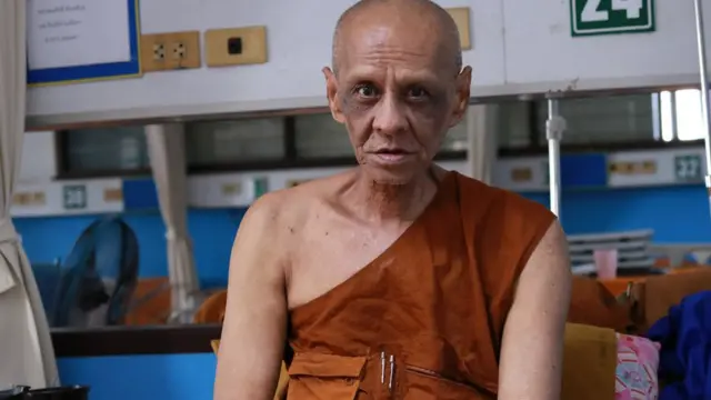 พระสมศักดิ์ พระวัดป่าใน จ.สระแก้ว เลิกบุหรี่ตั้งแต่ปี 2536 ปัจจุบันอาพาธด้วยโรคมะเร็งโพรงจมูก