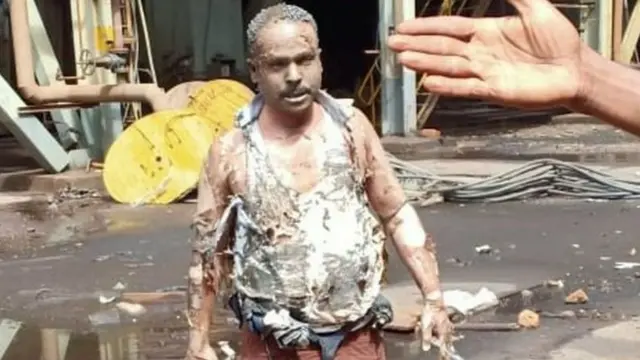 గాయాలపాలైన సిబ్బంది