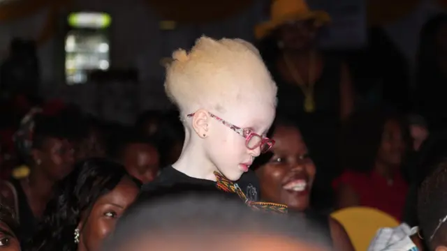 Msichana huyu aliduwazwa na maonyesho hayo! Ni katika maonyesho ya urembo kwa watu walio na ulemavu wa ngozi jijini Nairobi tarehe 21, Oktoba 2016