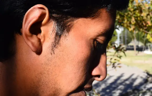 Рогеиро показује повреду на уху