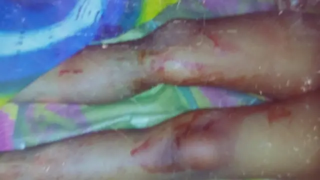 উদ্ধারের পর শিশুটির গায়ে আঘাতের চিহ্নও দেখেন কর্মকর্তারা।