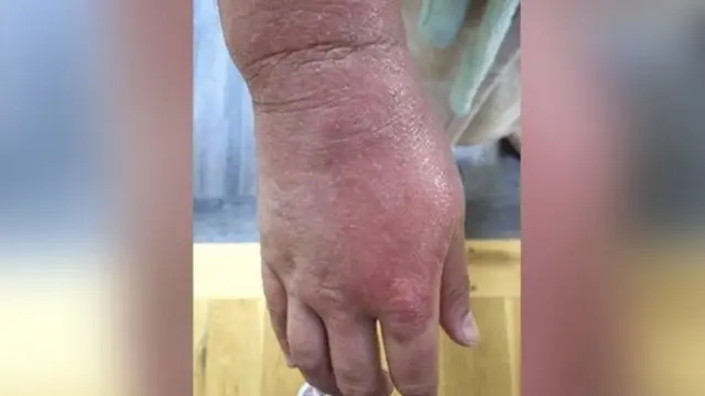 "مثل قفازات حمراء"