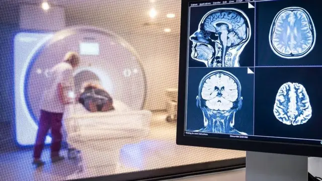 Un patient subit un scanner cérébral à l'hôpital