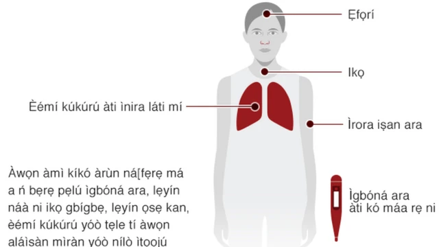 Apẹẹrẹ aarun coronavirus