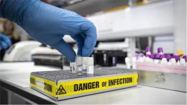 సైటోకిన్ స్టార్మ్