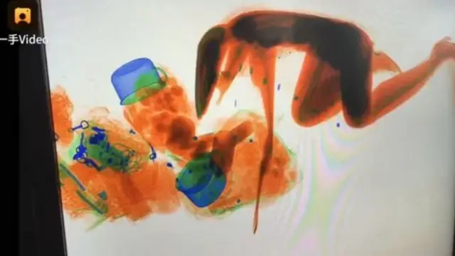 एक्सरे मशीन में ली गई तस्वीर