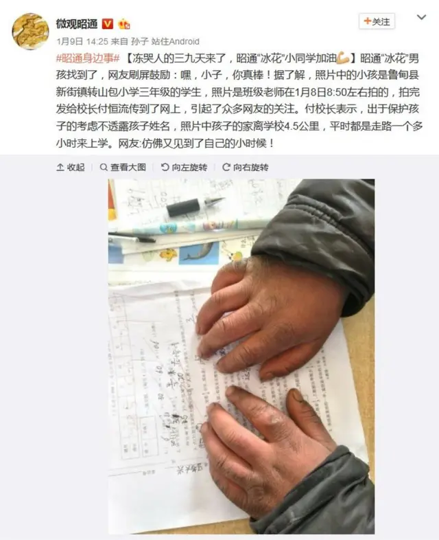 微博截屏：微观昭通展示王福满的手