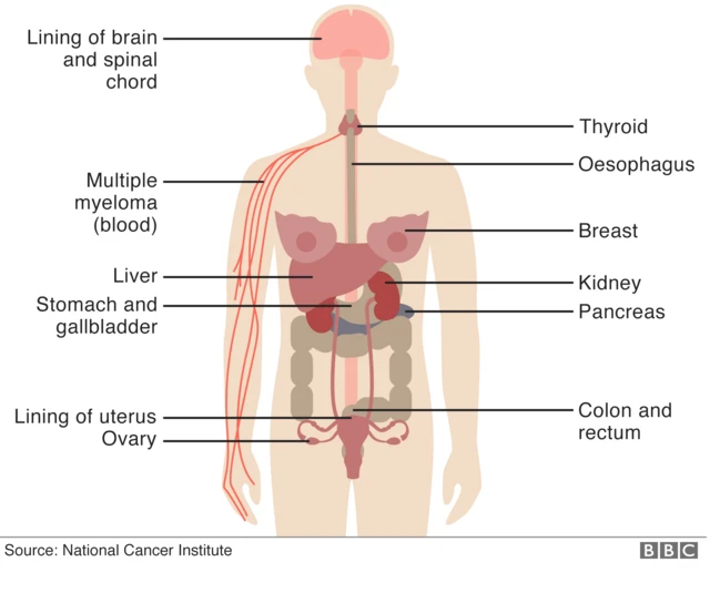 Mchoro huu unaonyesha mwili wa mwanamke na viungo vya mwili ambapo kunenepa kupoitia kiasi husababishwa.
