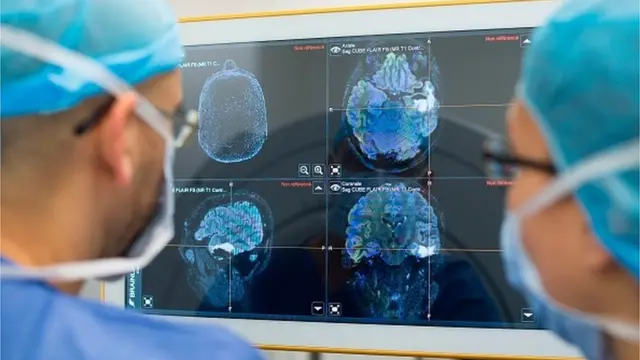 нейрохірурги