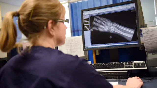 Рентген руки