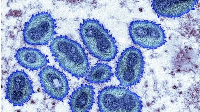 मङ्कीपक्स भाइरस