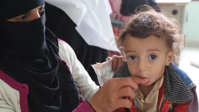 Save the Children Yemen fotoğrafı