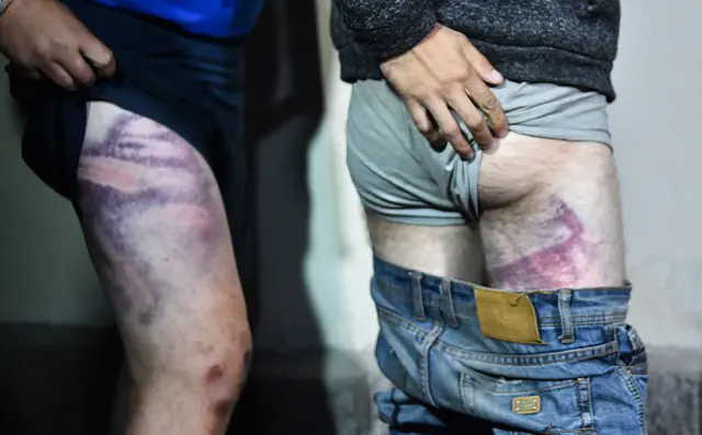 Окрестина пытки