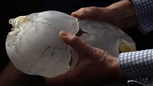 वेगवेगळ्या मॉडल्सच्या साहाय्याने त्यांच्या डोक्याची रचना कशी आहे याचा अभ्यास करण्यात आला.