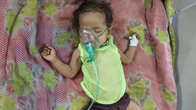 કુપોષિત બાળક