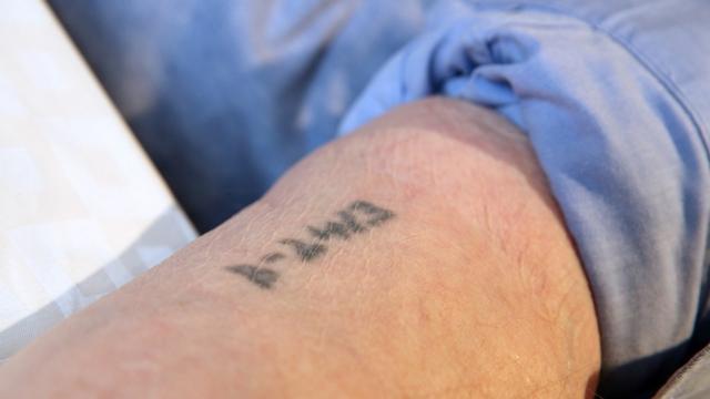 Sam Laskier's forearm showing his concentration camp tattoo - number B-2413