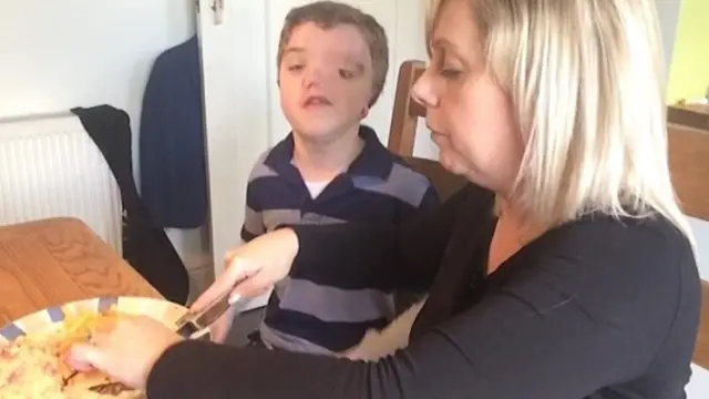 وقتی من بمیرم بر سر فرزند معلولم چه میآید؟