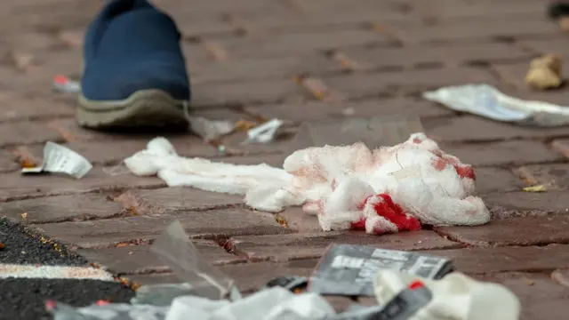 آثار الهجوم