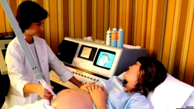 गर्भवती, महिला