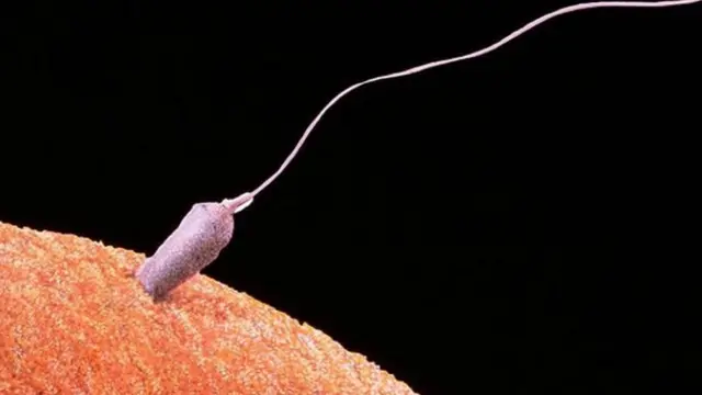 Сперматозоид