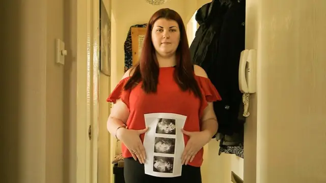 Kim tiene Síndrome de ovario poliquístico.