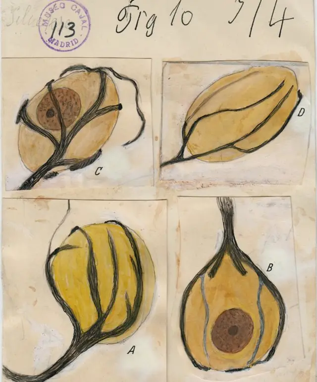 Cálices de Held en el núcleo del cuerpo trapezoidal. (Del libro "The Beautiful Brain", editorial Abrams. Imagen cortesía del Instituto Cajal del Consejo Superior de Investigaciones Científicas, Madrid © 2017)