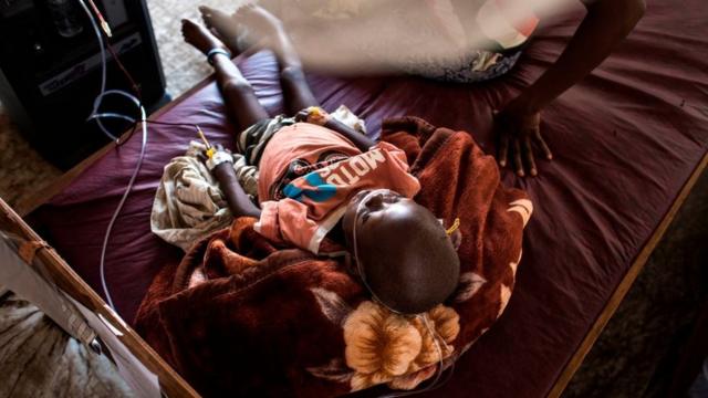 unicef prévient que les enfants sont en danger, plusieurs milliers risquent de mourir de malnutrition