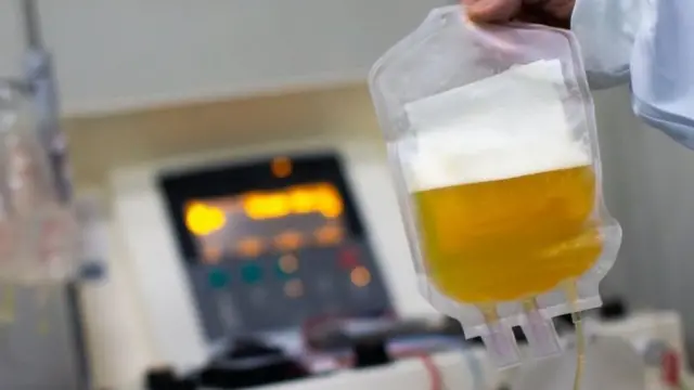 प्लाज़्मा थेरेपी